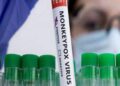 India Reports First Case of Mpox Clade 1b in Kerala: 38-Year-Old Man Recently Returned from UAE